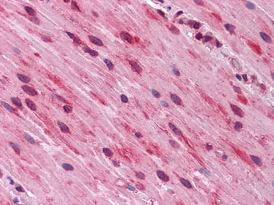 Figure 2: Immunohistochemical analysis of paraffin-embedded human Small Intestine, muscularis propria tissues using anti-GATA3 mouse mAb