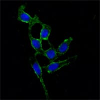 Figure 2: Immunofluorescence analysis of A549 cells using FAK mouse mAb (green). Blue: DRAQ5 fluorescent DNA dye.