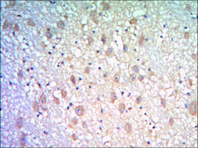 Figure 2: Immunohistochemical analysis of paraffin-embedded human brain tissues using KLHL21 mouse mAb with DAB staining.