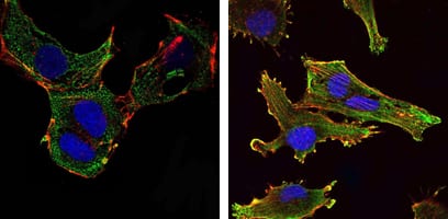 Figure 2: Immunofluorescence analysis of NTERA-2 cells (left) and U251 (right) cells using KLHL13 mouse mAb (green). Blue: DRAQ5 fluorescent DNA dye. Red: Actin filaments have been labeled with Alexa Fluor-555 phalloidin.