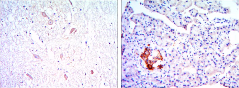 Figure 3: Immunohistochemical analysis of paraffin-embedded brain tissues (left) and pancreas tissues (right) using KLHL13 mouse mAb with DAB staining.