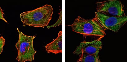 Figure 2: Immunofluorescence analysis of U251 (left) and NTERA2 (right) cells using CRTC1 mAb (green). Red: Actin filaments have been labeled with DY-554 phalloidin. Blue: DRAQ5 fluorescent DNA dye.