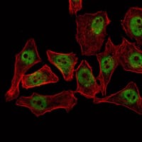 Figure 3: Immunofluorescence analysis of NTERA-2 cells using THAP11 mouse mAb (green). Red: Actin filaments have been labeled with Alexa Fluor-555 phalloidin.