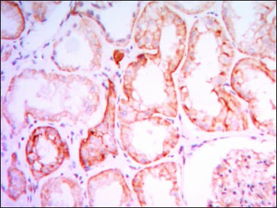 Figure 2: Immunohistochemical analysis of paraffin-embedded human kidney tissues using PTH1R mouse mAb with DAB staining.