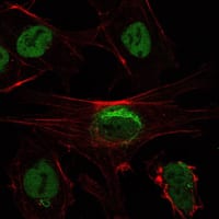 Figure 3: Immunofluorescence analysis of NTERA-2 cells using SIRT1 mouse mAb (green). Red: Actin filaments have been labeled with Alexa Fluor-555 phalloidin.