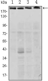 Figure 1: Western blot analysis using RICTOR mouse mAb against Hela (1), PANC-1 (2), MOLT4 (3), and HepG2 (4) cell lysate.