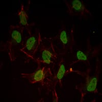 Figure 3: Immunofluorescence analysis of Hela cells using ESR1 mouse mAb (green). Red: Actin filaments have been labeled with Alexa Fluor-555 phalloidin.