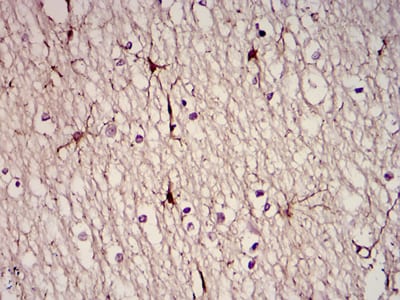 Figure 2: Immunohistochemical analysis of paraffin-embedded brain tissues using GFAP mouse mAb with DAB staining