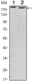 Figure 1: Western blot analysis using ERBB2 mouse mAb against SKBR3 (1) and MCF-7 (2) cell lysate.