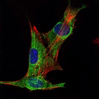 Figure 2: Immunofluorescence analysis of PANC-1 cells using INHA mouse mAb (green). Blue: DRAQ5 fluorescent DNA dye. Red: Actin filaments have been labeled with Alexa Fluor-555 phalloidin.