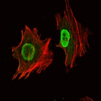 Figure 2: Immunofluorescence analysis of NTERA-2 cells using Oct4 mouse mAb (green). Red: Actin filaments have been labeled with Alexa Fluor-555 phalloidin.