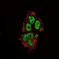 Figure 2: Immunofluorescence analysis of NTERA-2 cells using SOX2 mouse mAb (green). Red: Actin filaments have been labeled with Alexa Fluor-555 phalloidin.