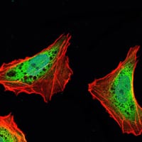 Figure 3: Immunofluorescence analysis of NTERA-2 cells using ATXN1 mouse mAb (green). Blue: DRAQ5 fluorescent DNA dye. Red: Actin filaments have been labeled with Alexa Fluor-555 phalloidin.