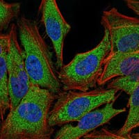 Figure 3: Immunofluorescence analysis of PC-2 cells using NR3C1 mouse mAb (green). Blue: DRAQ5 fluorescent DNA dye. Red: Actin filaments have been labeled with Alexa Fluor-555 phalloidin.