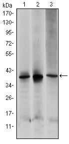 Figure 1: Western blot analysis using MAP2K6 mouse mAb against HepG2 (1), MCF-7 (2) and NIH/3T3 (3) cell lysate.