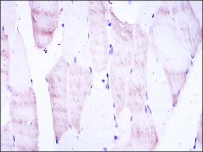 Figure 2: Immunohistochemical analysis of paraffin-embedded muscle tissues using OLIG2 mouse mAb with DAB staining.