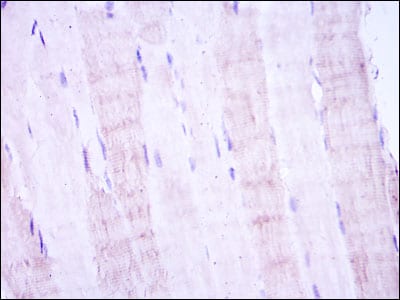 Figure 2: Immunohistochemical analysis of paraffin-embedded muscle tissues using MAP2K4 mouse mAb with DAB staining.