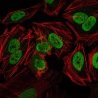 Figure 4: Immunofluorescence analysis of Hela cells using PRKDC mouse mAb (green). Red: Actin filaments have been labeled with Alexa Fluor-555 phalloidin.