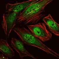 Figure 2: Immunofluorescence analysis of Hela cells using RUNX1 mouse mAb (green). Red: Actin filaments have been labeled with Alexa Fluor-555 phalloidin.