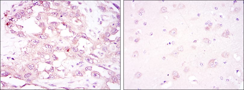 Figure 2: Immunohistochemical analysis of paraffin-embedded ovarian cancer (left) and brain tissues (right) using PRKAA1 mouse mAb with DAB staining.