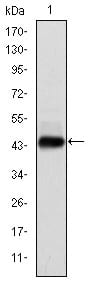 Figure 1: Western blot analysis using E7 mAb against human E7 (AA: 1-98) recombinant protein.