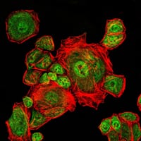 Figure 3: Immunofluorescence analysis of Eca109 cells using CDK1 mouse mAb (green). Red: Actin filaments have been labeled with Alexa Fluor-555 phalloidin.