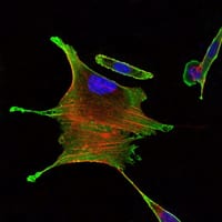 Figure 3: Immunofluorescence analysis of Eca109 cells using BMPR2 mouse mAb (green). Blue: DRAQ5 fluorescent DNA dye. Red: Actin filaments have been labeled with Alexa Fluor-555 phalloidin.