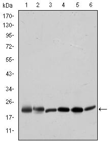 Figure 1: Western blot analysis using BID mouse mAb against Hela (1), A431 (2), Jurkat (3), A549 (4), HepG2 (5), and HEK293 (6) cell lysate.