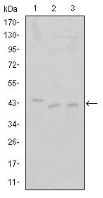 Figure 1: Western blot analysis using CDK9 mouse mAb against Jurkat (1), A431 (2) and HEK293 (3) cell lysate.