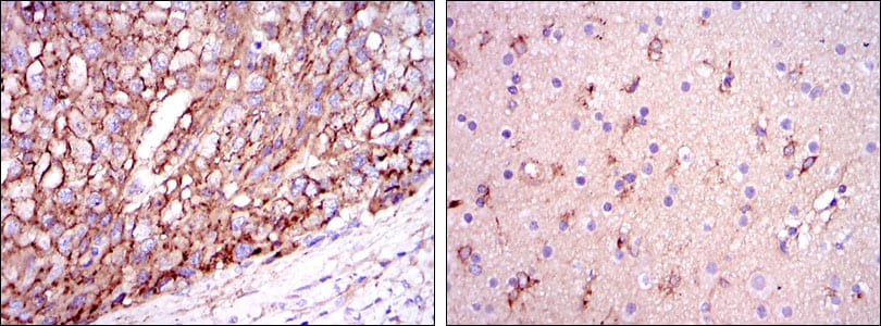 Figure 2: Immunohistochemical analysis of paraffin-embedded liver cancer tissues (left) and brain tissues (right) using ApoE mouse mAb with DAB staining.