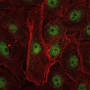 Figure 3: Immunofluorescence analysis of U251 cells using c-Rel mouse mAb (green). Blue: DRAQ5 fluorescent DNA dye. Red: Actin filaments have been labeled with Alexa Fluor-555 phalloidin.