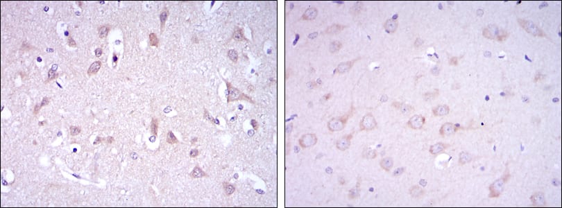 Figure 2: Immunohistochemical analysis of paraffin-embedded human brain tissues (left) and rat brain tissues (right) using GRIA3 mouse mAb with DAB staining.