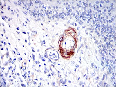 Figure 3: Immunohistochemical analysis of paraffin-embedded human esophagus tissues using GKAP mouse mAb with DAB staining.