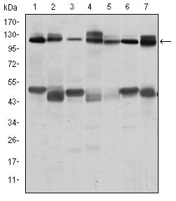 Figure 2: Western blot analysis using C-CBL mouse mAb against RAJI (1), RAW264.7 (2), K562 (3), SKBR-3 (4), 3T3-L1 (5), THP-1 (6) and PC-12 (7) cell lysate.