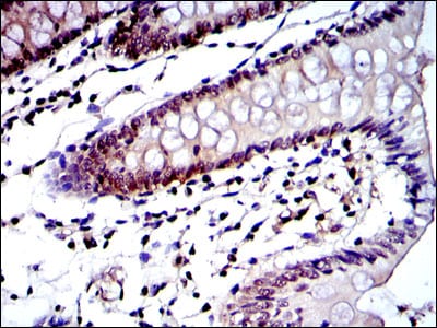 Figure 4: Immunohistochemical analysis of paraffin-embedded colon tissues using PSMB8 mouse mAb with DAB staining.