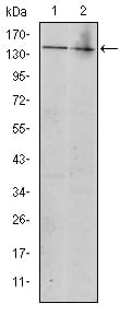 Figure 2: Western blot analysis using KIT mouse mAb against Jurkat (1) and Hela (2) cell lysate.