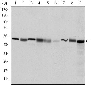 Figure 2: Western blot analysis using CCT2 mouse mAb against Hela (1), MCF-7 (2), Jurkat (3), T47D (4), K562 (5), A431 (6), NIH/3T3 (7), PC-12 (8) and Cos7 (9) cell lysate.