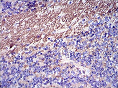 Figure 2: Immunohistochemical analysis of paraffin-embedded cerebellum tissues using FGG mouse mAb with DAB staining.