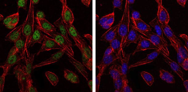 Figure 3: Immunofluorescence analysis of 3T3-L1 cells using CCT2 mouse mAb (green). Blue: DRAQ5 fluorescent DNA dye. Red: Actin filaments have been labeled with Alexa Fluor-555 phalloidin.