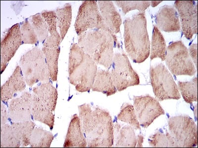 Figure 5: Immunohistochemical analysis of paraffin-embedded striated muscle tissues using TNNI2 mouse mAb with DAB staining.