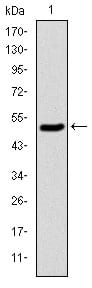 Figure 1: Western blot analysis using KID mAb against human KID (AA: 225-419) recombinant protein. (Expected MW is 47 kDa)