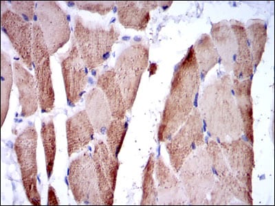 Figure 4: Immunohistochemical analysis of paraffin-embedded striated muscle tissues using TNNI2 mouse mAb with DAB staining.