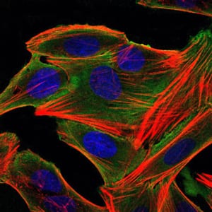 Figure 3: Immunofluorescence analysis of HepG2 cells using RSK2 mouse mAb (green). Blue: DRAQ5 fluorescent DNA dye. Red: Actin filaments have been labeled with Alexa Fluor-555 phalloidin.