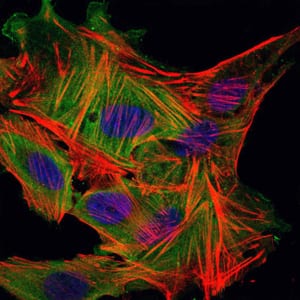 Figure 5: Immunofluorescence analysis of MSCS cells using MBP mouse mAb (green). Blue: DRAQ5 fluorescent DNA dye. Red: Actin filaments have been labeled with Alexa Fluor-555 phalloidin.