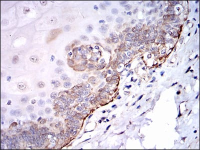 Figure 4: Immunohistochemical analysis of paraffin-embedded esophageal tissues using SRC mouse mAb with DAB staining.