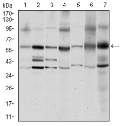 Figure 2: Western blot analysis using SRC mouse mAb against MCF-7 (1), A431 (2), Hela (3), HEK293 (4), NIH/3T3 (5), PC-12 (6) and Cos7 (7) cell lysate.