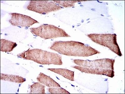 Figure 3: Immunohistochemical analysis of paraffin-embedded muscle tissues using MAP2K7 mouse mAb with DAB staining.