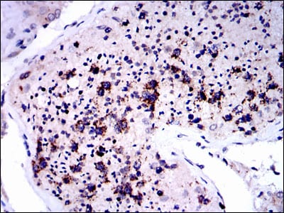 Figure 3: Immunohistochemical analysis of paraffin-embedded testis tissues using NQO1 mouse mAb with DAB staining.