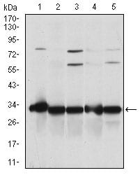 Figure 2: Western blot analysis using NQO1 mouse mAb against A549 (1), SKNES (2), HepG2 (3), MCF-7 (4) and Hela (5) cell lysate.