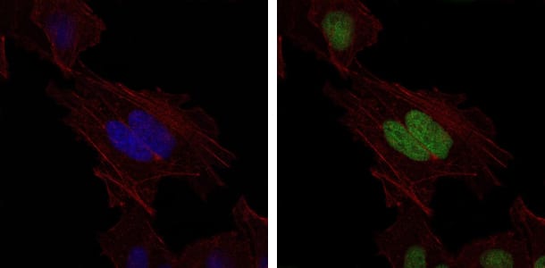 Figure 5: Immunofluorescence analysis of Hela cells using MSH6 mouse mAb (green). Blue: DRAQ5 fluorescent DNA dye. Red: Actin filaments have been labeled with Alexa Fluor-555 phalloidin.